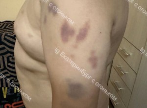 В детском оздоровительном лагере в Свердловской области жестоко избили ребёнка