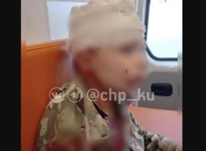 В Каменске-Уральском дети бутылкой разбили голову мальчику