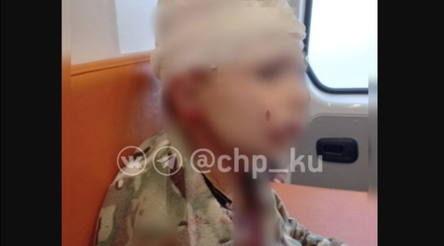 В Каменске-Уральском дети бутылкой разбили голову мальчику