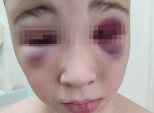 Россиянка обвинила участника спецоперации в избиении 10-летнего сына палками