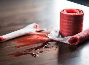 «Большие сгустки крови». В магазин на Краснолесья пришел раненый мужчина